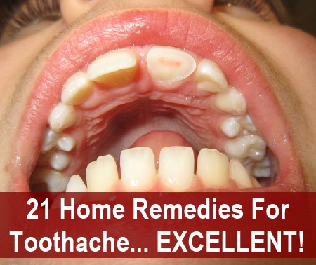 Home Remedies for a Toothache
